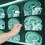 BrainScan BrainScan