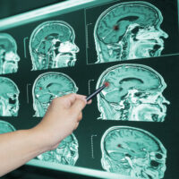 BrainScan BrainScan