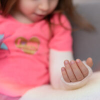 InjuredArmTodler InjuredArmTodler