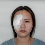 InjuryEye5