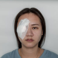 InjuryEye5