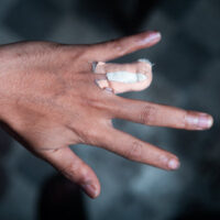 InjuredHand5 InjuredHand5